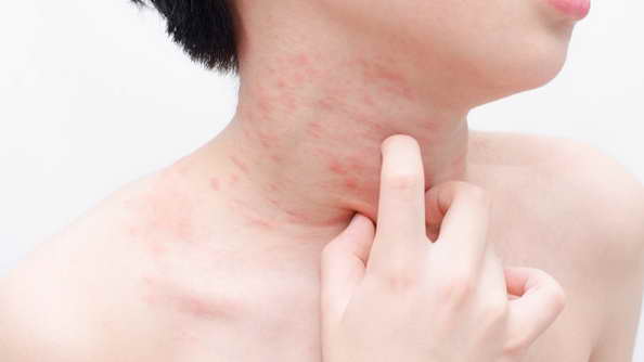 預防梅毒：自尊自愛是底線，這些實操方法築牢健康防線-情愛百科